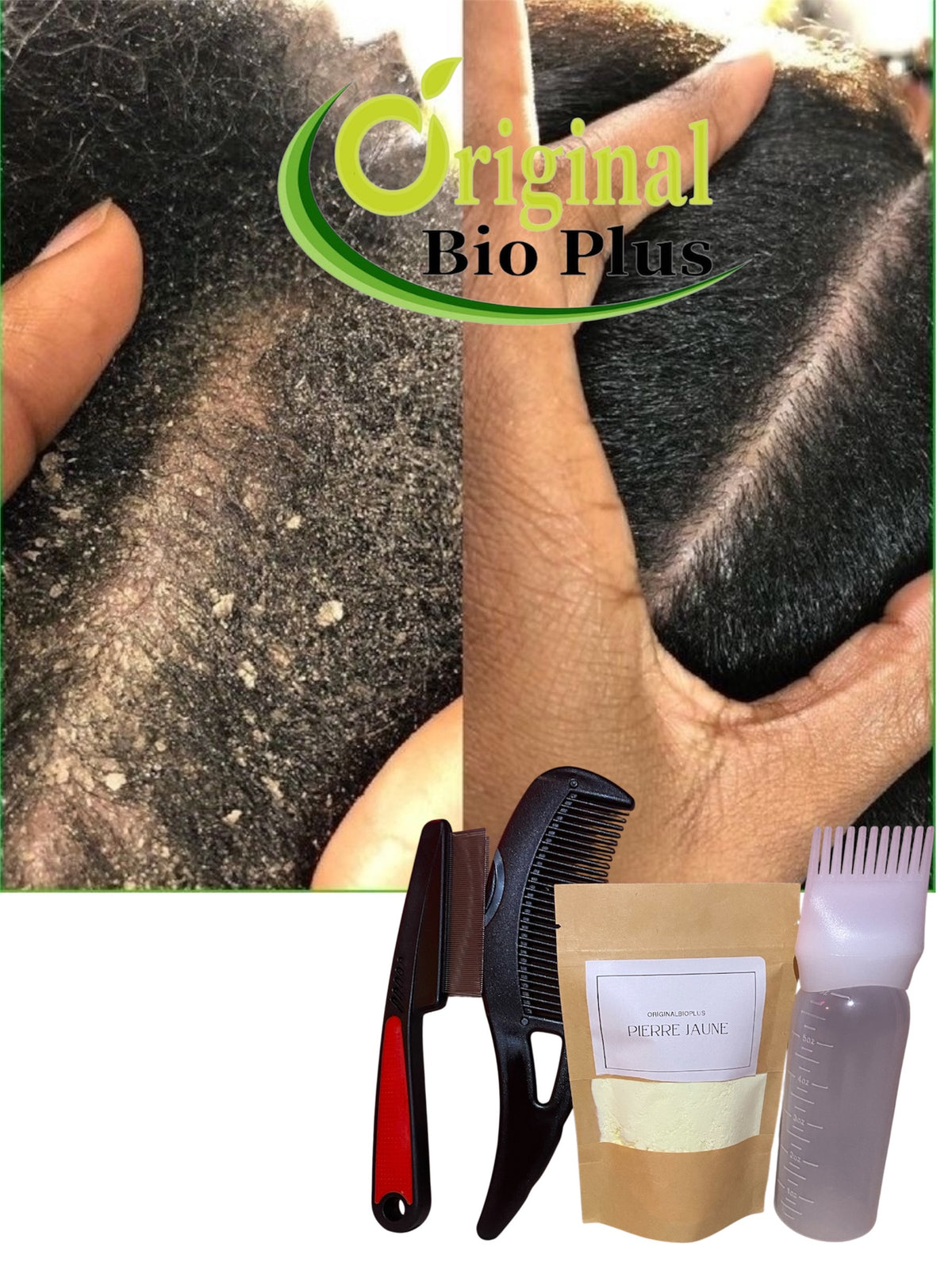 pack anti-psoriasis