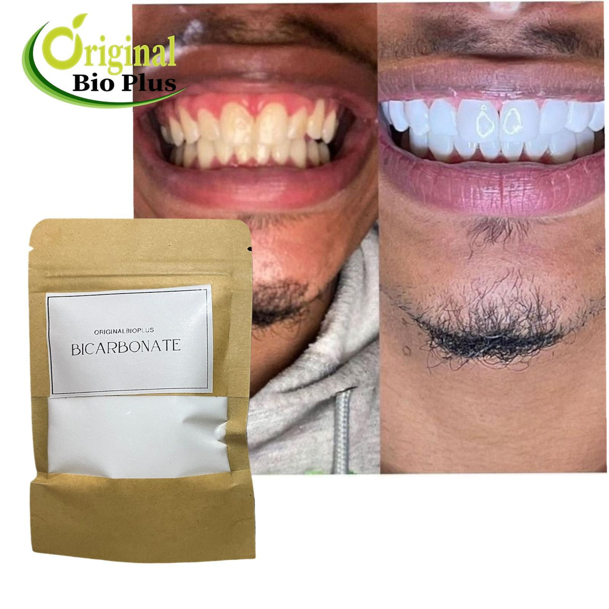 Bicarbonate de soude dentaire